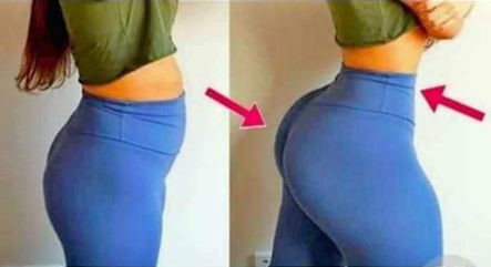 pmma-hydrogel-booty-injections-in-zimbabwe27-74-676-7021
