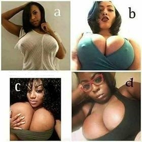 breasts-enlargement-and-reduction-in-cape-town27-74-676-7021